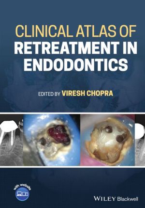 Clinical Atlas of Retreatment in Endodontics | ABC Books