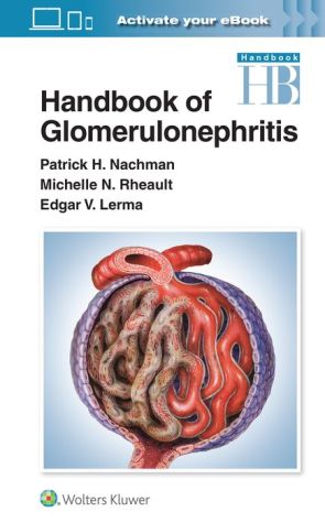 Handbook of Glomerulonephritis | ABC Books