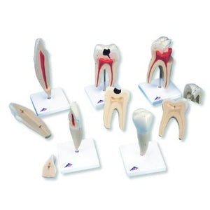 Dentistry Model-Human Tooth Models Set-Classic Series-5 Models-3B(CM):29 | ABC Books