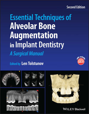 Essential Techniques of Alveolar Bone Augmentation in Implant Dentistry: A Surgical Manual, 2e | ABC Books