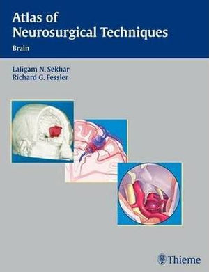 Atlas of Neurosurgical Techniques : Brain** | ABC Books
