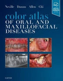 Color Atlas of Oral and Maxillofacial Diseases | ABC Books