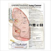 Understanding Lung Cancer Anatomical Chart | ABC Books