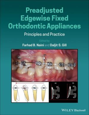 Preadjusted Edgewise Fixed Orthodontic Appliances: Principles and Practice | ABC Books
