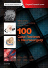 100 Case Reviews in Neurosurgery | ABC Books