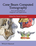 Cone Beam Computed Tomography - Oral and Maxillofacial Diagnosis and Applications | ABC Books