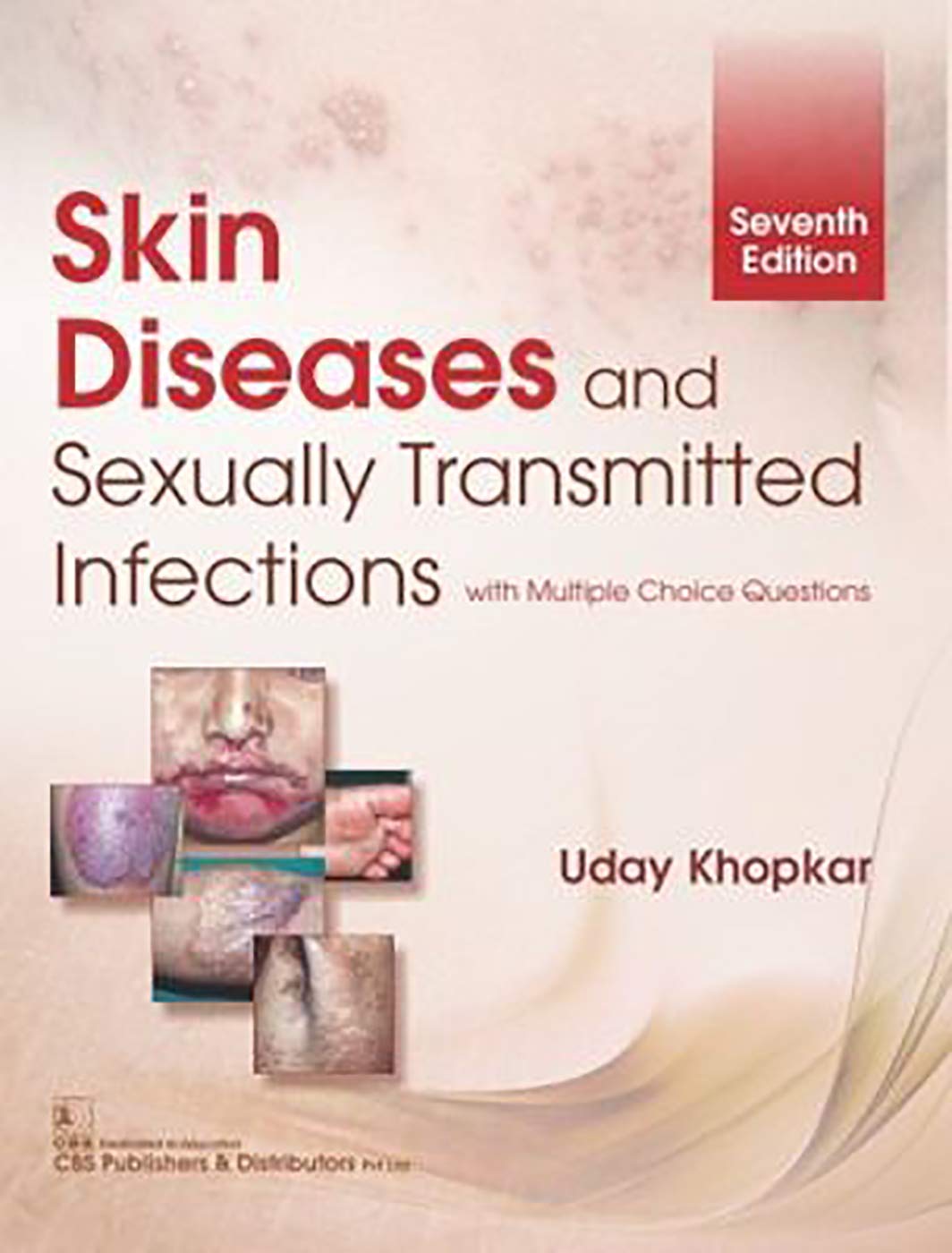 Skin Diseases and Sexually Transmitted Infections, with Multiple Choice Questions, 7e