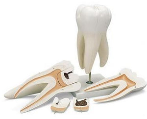 Dentistry Model-Giant Molar with Dental Cavities Human Tooth Model, 15 Times Life-Size, 6 Part-3B(CM):24x13x12 | ABC Books