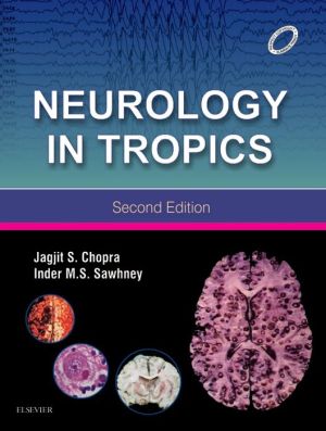 Neurology in Tropics, 2e | ABC Books
