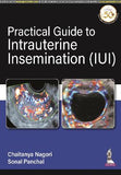 Practical Guide to Intrauterine Insemination (IUI) | ABC Books
