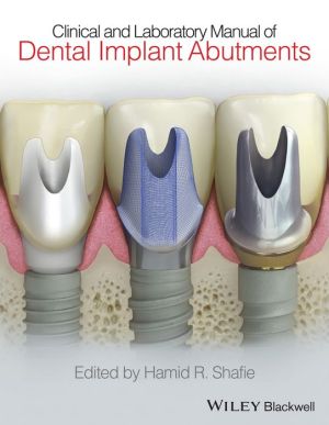 Clinical and Laboratory Manual of Dental Implant Abutments | ABC Books