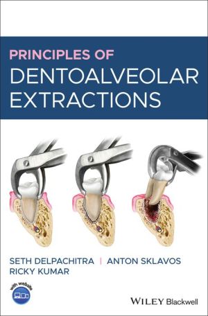 Principles of Dentoalveolar Extractions | ABC Books