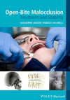 Open-Bite Malocclusion - Treatment and Stability | ABC Books