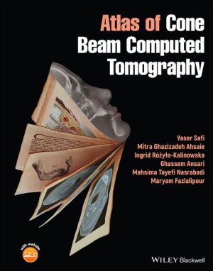 Atlas of Cone Beam Computed Tomography | ABC Books