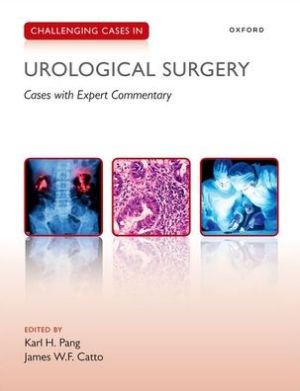 Challenging Cases in Urological Surgery | ABC Books