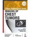 Clinico Radiological Series Imaging of Chest Tumors | ABC Books