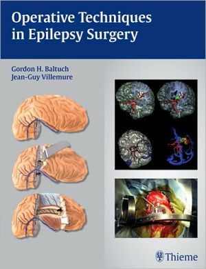 Operative Techniques in Epilepsy Surgery** | ABC Books