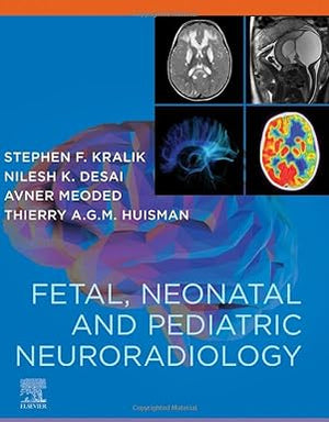 Fetal, Neonatal and Pediatric Neuroradiology | ABC Books