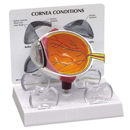Eye Model-Cornea Eyet- GPI-Size(CM): 17x14x13