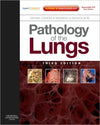 Pathology of the Lungs, 3rd Edition ** | ABC Books