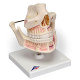 Dentistry Model-Adult Denture Model with Nerves and Roots-3B(CM):16x13x12 | ABC Books