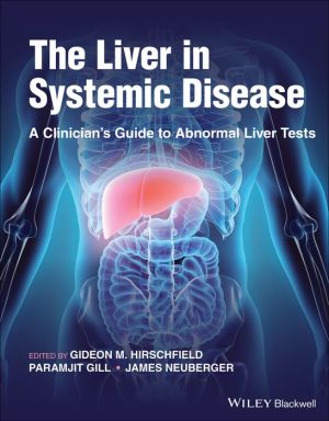 The Liver in Systemic Disease: A Clinician's Guide to Abnormal Liver Tests | ABC Books
