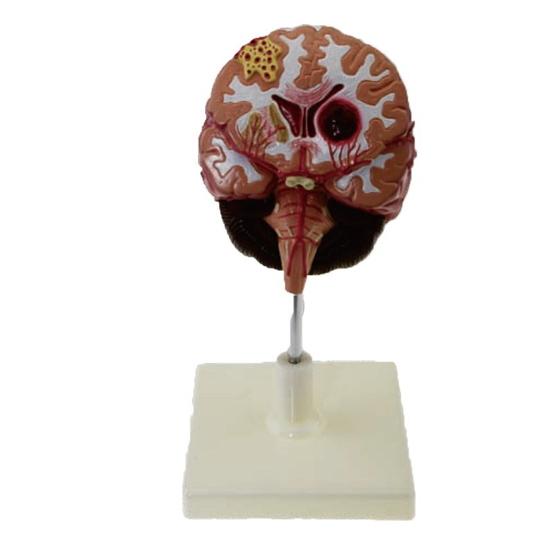 Brain Model-Model of Brain Pathologies- Sciedu-(CM):14x12x12