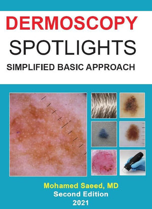 Dermoscopy Spotlights : Simplified Basic Approach, 2e | ABC Books