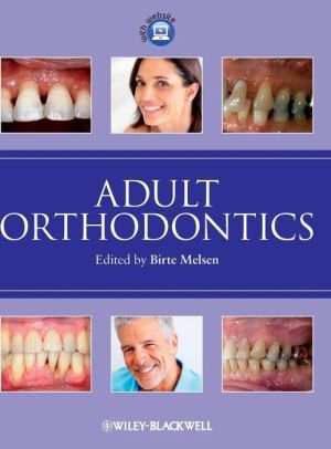 Adult Orthodontics** | ABC Books