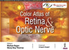 Color Atlas of Retina & Optic Nerve | ABC Books