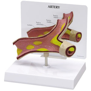 Thoracic Model-Artery Model-Oversize-with Plaque Build-Up-GPI-Size(CM): 16x16x12 | ABC Books