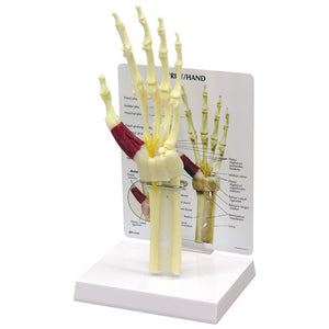 Bone Model-Hand/Wrist Carpal Tunnel Syndrome- GPI-Size(CM): 35x16x13 | ABC Books