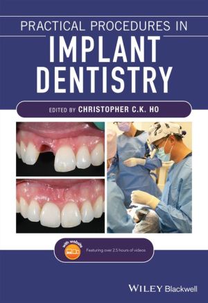 Practical Procedures in Implant Dentistry | ABC Books