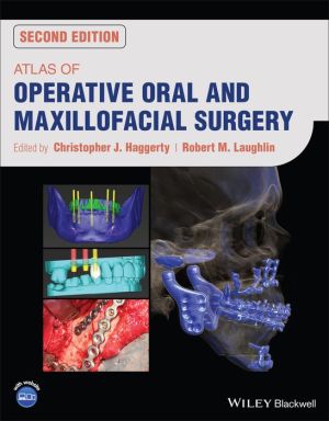 Atlas of Operative Oral and Maxillofacial Surgery, 2e | ABC Books
