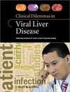 Clinical Dilemmas in Viral Liver Disease** | ABC Books