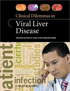 Clinical Dilemmas in Viral Liver Disease** | ABC Books
