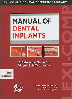 Manual of Dental Implants 2e ** ( USED Like NEW )