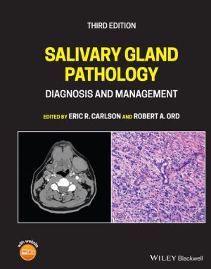 Salivary Gland Pathology: Diagnosis and Management, 3e | ABC Books