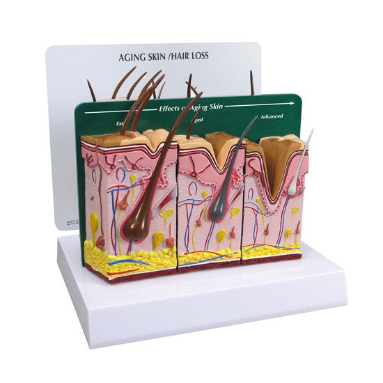 Skin Model-Aging Skin / Hair Loss & Normal Skin- GPI (CM): 16x12x13 | GPI