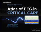 Hirsch and Brenner's Atlas of EEG in Critical Care, 2e | ABC Books