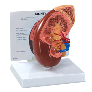 Urology Model- Kidney Normal- GPI (CM): 20x16x13 | ABC Books
