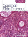 Common Skin Diseases, 18e | ABC Books