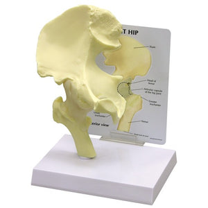 Bone Model-Basic Hip- GPI (CM): 23x18x17 | ABC Books