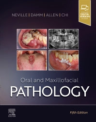 Oral and Maxillofacial Pathology, 5e | ABC Books