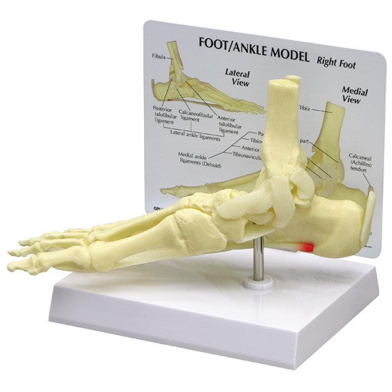 Bone Model-Foot/Ankle – Plantar Fasciitis-GPI-Size(CM): 26x15x13