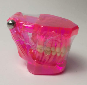 Dentistry Model-Pathology Model with Implant- TJIRIS (CM):10x8x6 CM | ABC Books