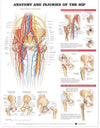 Anatomy and Injuries of the Hip Anatomical Chart Plastic | ABC Books