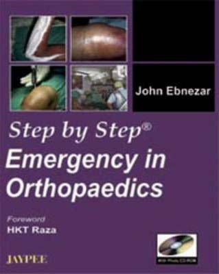 Step By Step Emergency in Orthopaedics with Photo CD-ROM