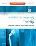 Arthritis and Arthroplasty: The Hip, Expert Consult - Online, Print and DVD