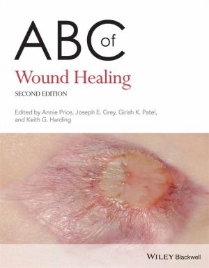 ABC of Wound Healing, 2e | ABC Books